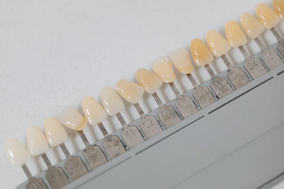 הלבנת שיניים אילת
