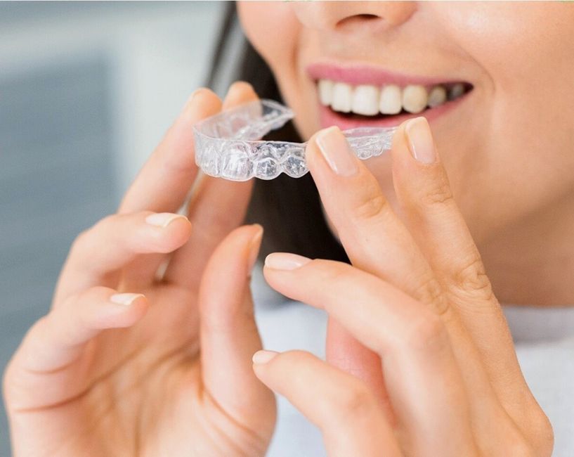 Invisalign · יישור שקוף אשקלון