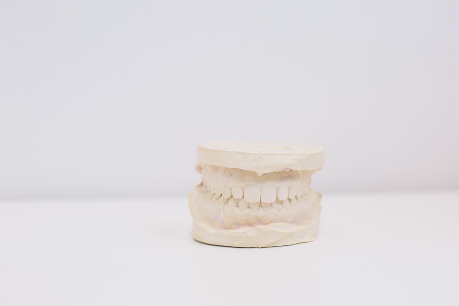 Invisalign · יישור שקוף אשדוד