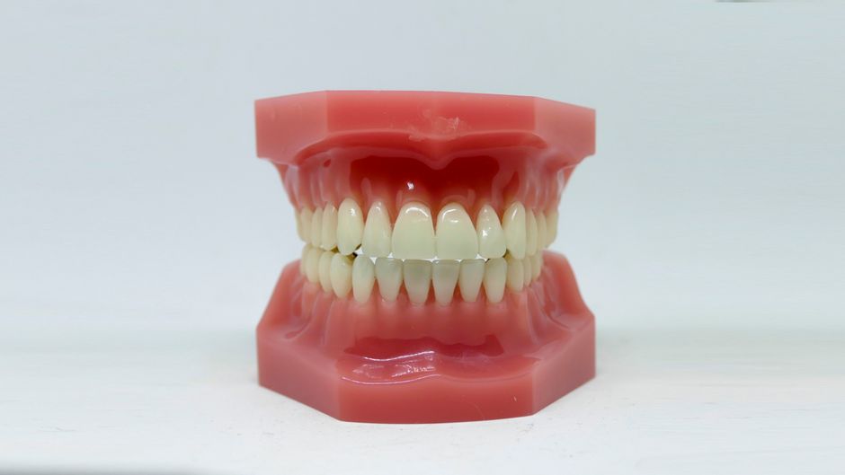 Invisalign · יישור שקוף אשדוד